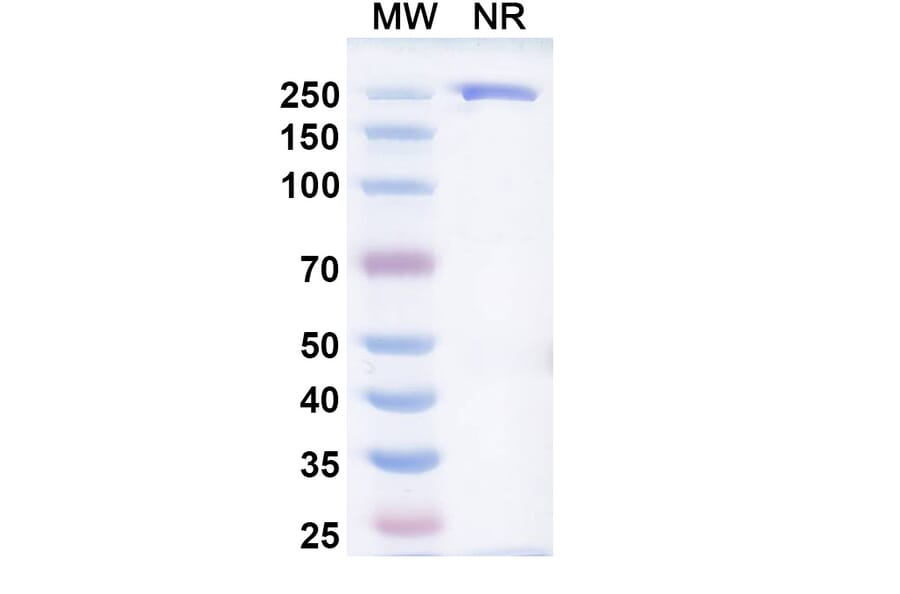 SDS-PAGE - Firastotug Biosimilar - Anti-CTLA-4 Antibody - BSA and Azide free (A340464) - Antibodies.com