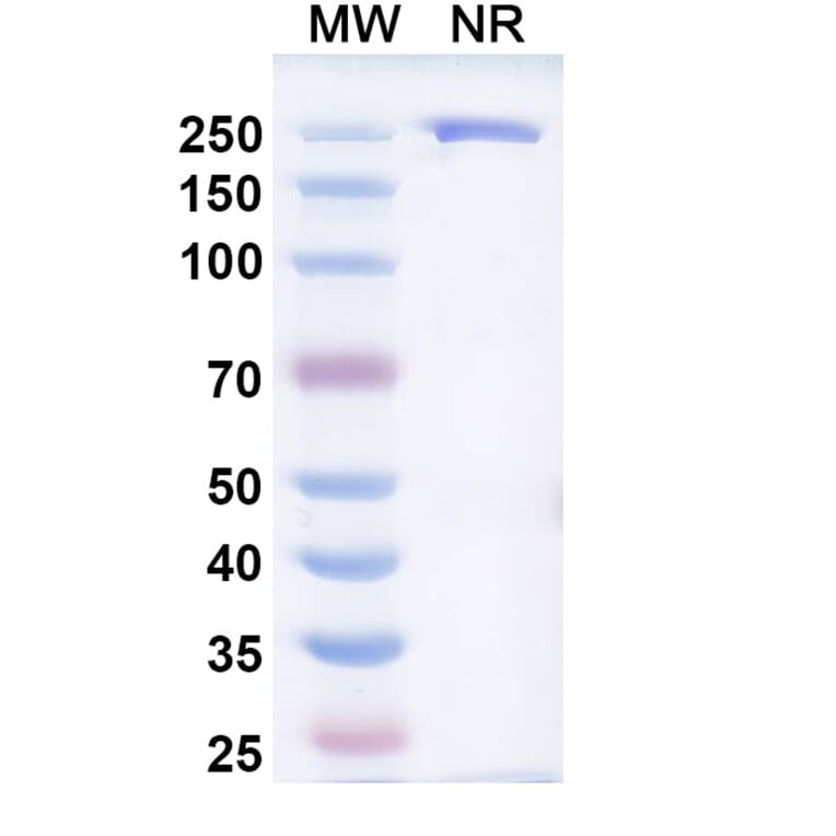 SDS-PAGE - Firastotug Biosimilar - Anti-CTLA-4 Antibody - BSA and Azide free (A340464) - Antibodies.com