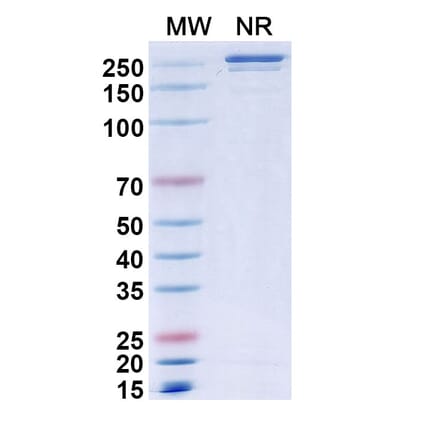 SDS-PAGE - Muzastotug Biosimilar - Anti-CTLA-4 Antibody - BSA and Azide free (A340466) - Antibodies.com