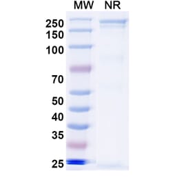 SDS-PAGE - Sovipostobart Biosimilar - Anti-CTLA-4 Antibody - BSA and Azide free (A340467) - Antibodies.com