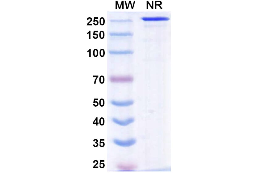 SDS-PAGE - Sovipostobart Biosimilar - Anti-CTLA-4 Antibody - BSA and Azide free (A340467) - Antibodies.com