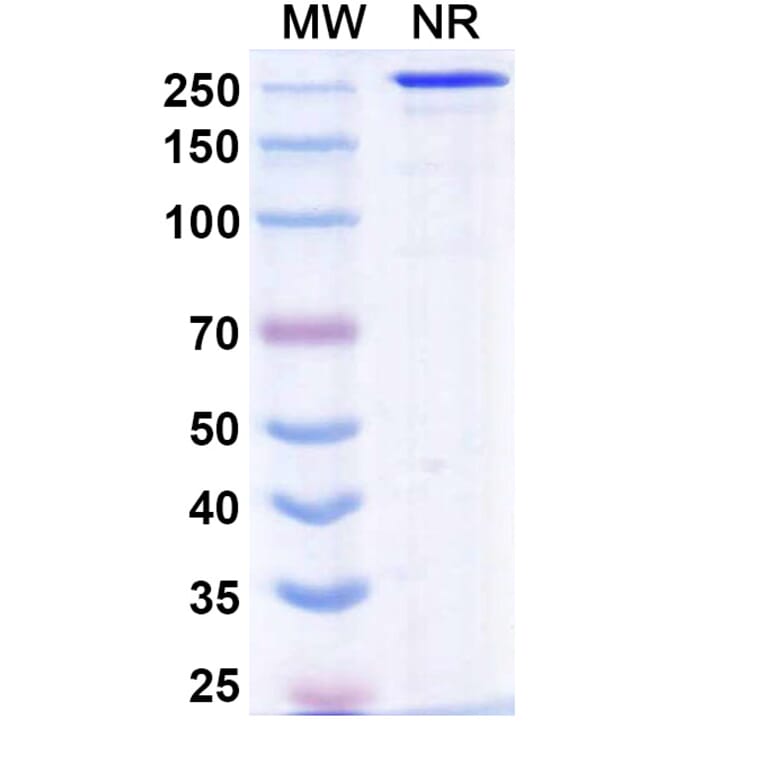SDS-PAGE - Sovipostobart Biosimilar - Anti-CTLA-4 Antibody - BSA and Azide free (A340467) - Antibodies.com