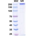 SDS-PAGE - Sovipostobart Biosimilar - Anti-CTLA-4 Antibody - BSA and Azide free (A340467) - Antibodies.com