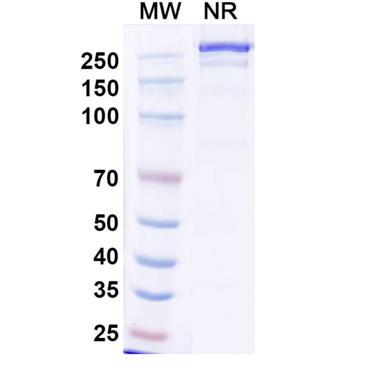 SDS-PAGE - Iluzanebart Biosimilar - Anti-TREM2 Antibody - BSA and Azide free (A340468) - Antibodies.com