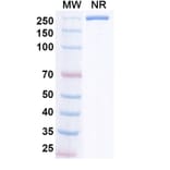 SDS-PAGE - Iluzanebart Biosimilar - Anti-TREM2 Antibody - BSA and Azide free (A340468) - Antibodies.com