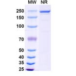 SDS-PAGE - Lixudebart Biosimilar - Anti-Claudin 1 Antibody - BSA and Azide free (A340470) - Antibodies.com