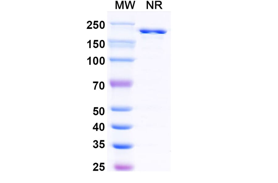 SDS-PAGE - Nelistotug Biosimilar - Anti-CD96 Antibody - BSA and Azide free (A340472) - Antibodies.com