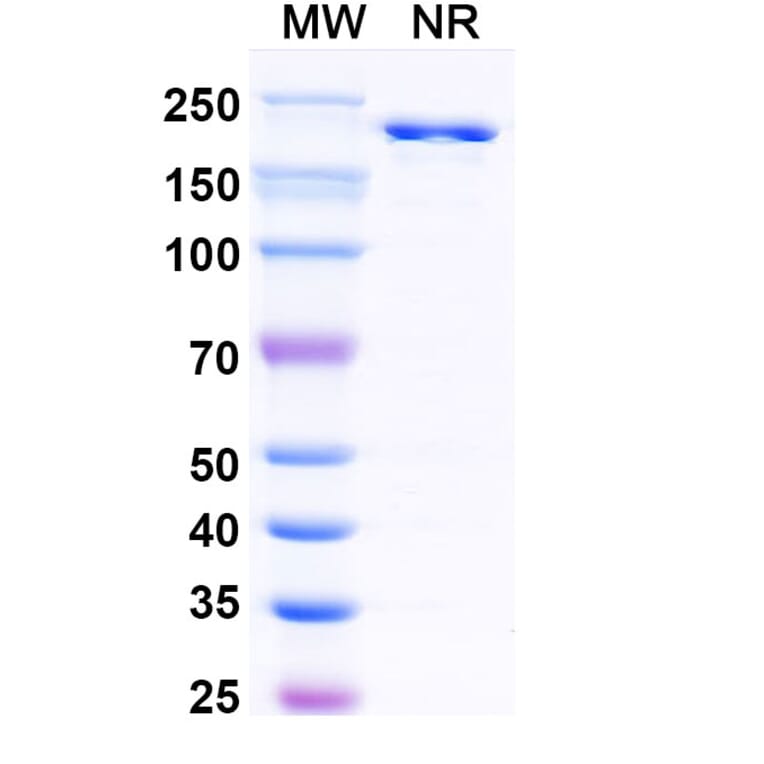SDS-PAGE - Nelistotug Biosimilar - Anti-CD96 Antibody - BSA and Azide free (A340472) - Antibodies.com