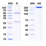 SDS-PAGE - Nolavetbart Biosimilar - Anti-IL-31RA Antibody - BSA and Azide free (A340474) - Antibodies.com