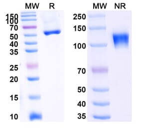 SDS-PAGE - Ozekibart Biosimilar - Anti-DR5 Antibody - BSA and Azide free (A340477) - Antibodies.com