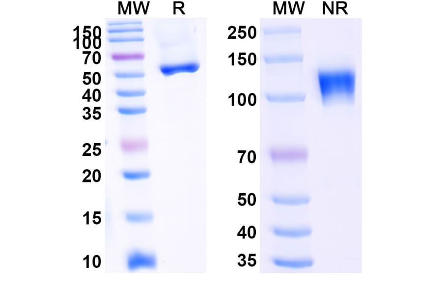 SDS-PAGE - Ozekibart Biosimilar - Anti-DR5 Antibody - BSA and Azide free (A340477) - Antibodies.com