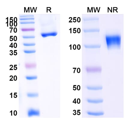 SDS-PAGE - Ozekibart Biosimilar - Anti-DR5 Antibody - BSA and Azide free (A340477) - Antibodies.com