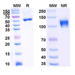 SDS-PAGE - Ozekibart Biosimilar - Anti-DR5 Antibody - BSA and Azide free (A340477) - Antibodies.com