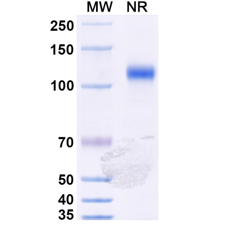 SDS-PAGE - Ozekibart Biosimilar - Anti-DR5 Antibody - BSA and Azide free (A340477) - Antibodies.com