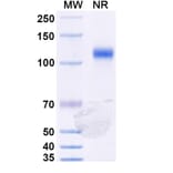 SDS-PAGE - Ozekibart Biosimilar - Anti-DR5 Antibody - BSA and Azide free (A340477) - Antibodies.com