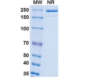 SDS-PAGE - Patecibart Biosimilar - Anti-Endothelin A Receptor Antibody - BSA and Azide free (A340478) - Antibodies.com