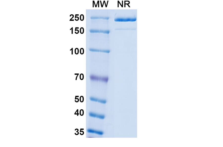 SDS-PAGE - Patecibart Biosimilar - Anti-Endothelin A Receptor Antibody - BSA and Azide free (A340478) - Antibodies.com