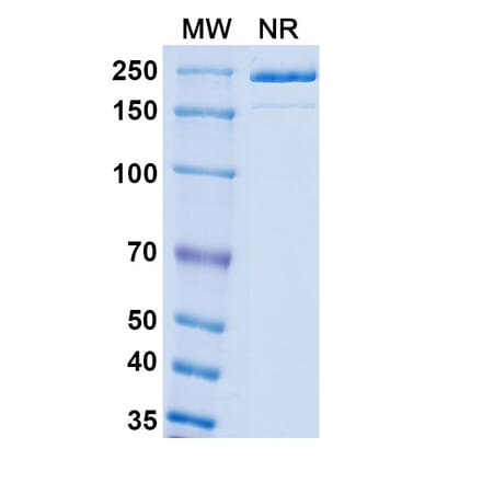 SDS-PAGE - Patecibart Biosimilar - Anti-Endothelin A Receptor Antibody - BSA and Azide free (A340478) - Antibodies.com