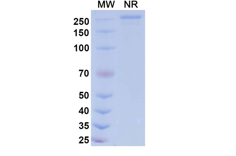 SDS-PAGE - Patecibart Biosimilar - Anti-Endothelin A Receptor Antibody - BSA and Azide free (A340478) - Antibodies.com