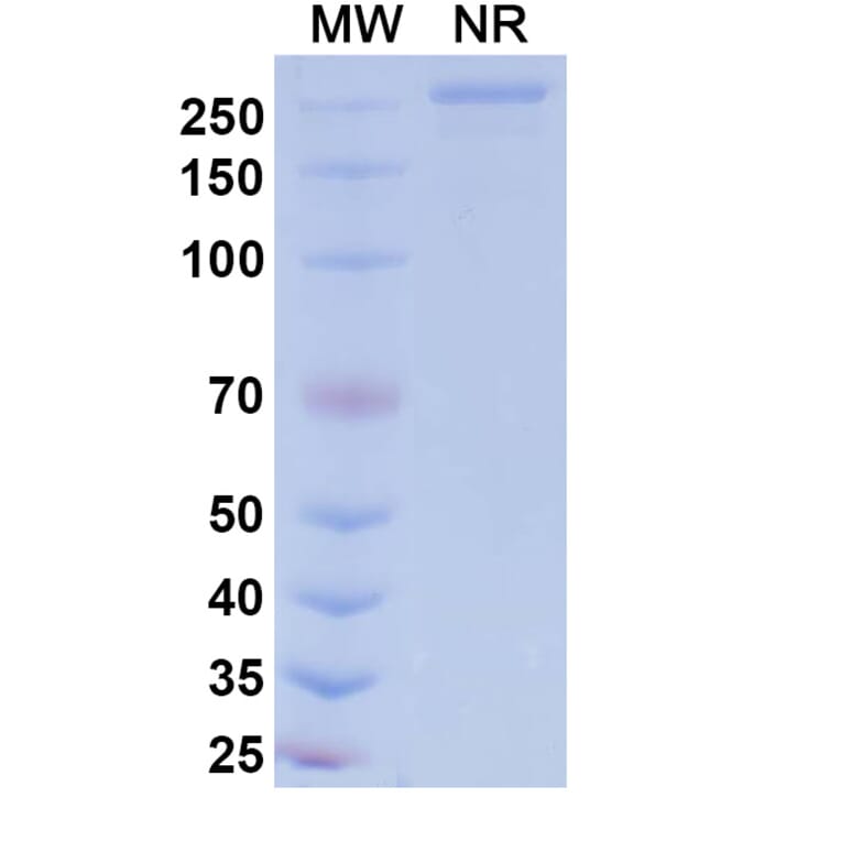 SDS-PAGE - Patecibart Biosimilar - Anti-Endothelin A Receptor Antibody - BSA and Azide free (A340478) - Antibodies.com
