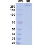 SDS-PAGE - Patecibart Biosimilar - Anti-Endothelin A Receptor Antibody - BSA and Azide free (A340478) - Antibodies.com