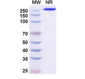 SDS-PAGE - Puxitatug Biosimilar - Anti-B7-H4 Antibody - BSA and Azide free (A340480) - Antibodies.com