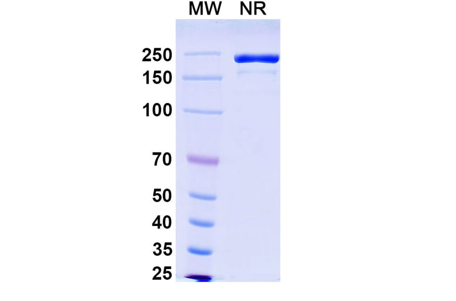SDS-PAGE - Rademikibart Biosimilar - Anti-IL-4R Antibody - BSA and Azide free (A340481) - Antibodies.com