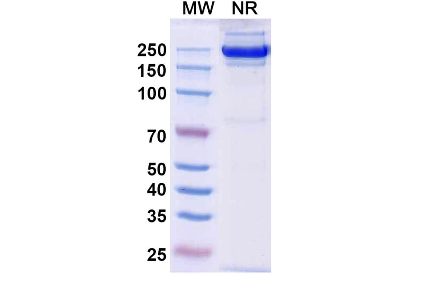 SDS-PAGE - Rademikibart Biosimilar - Anti-IL-4R Antibody - BSA and Azide free (A340481) - Antibodies.com