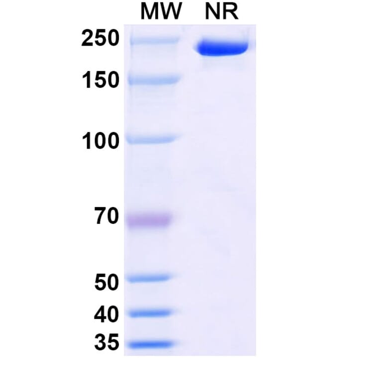 SDS-PAGE - Stapokibart Biosimilar - Anti-IL-4R Antibody - BSA and Azide free (A340482) - Antibodies.com