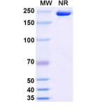 SDS-PAGE - Stapokibart Biosimilar - Anti-IL-4R Antibody - BSA and Azide free (A340482) - Antibodies.com