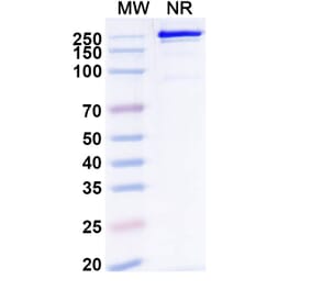 SDS-PAGE - Remternetug Biosimilar - Anti-APP Antibody - BSA and Azide free (A340483) - Antibodies.com