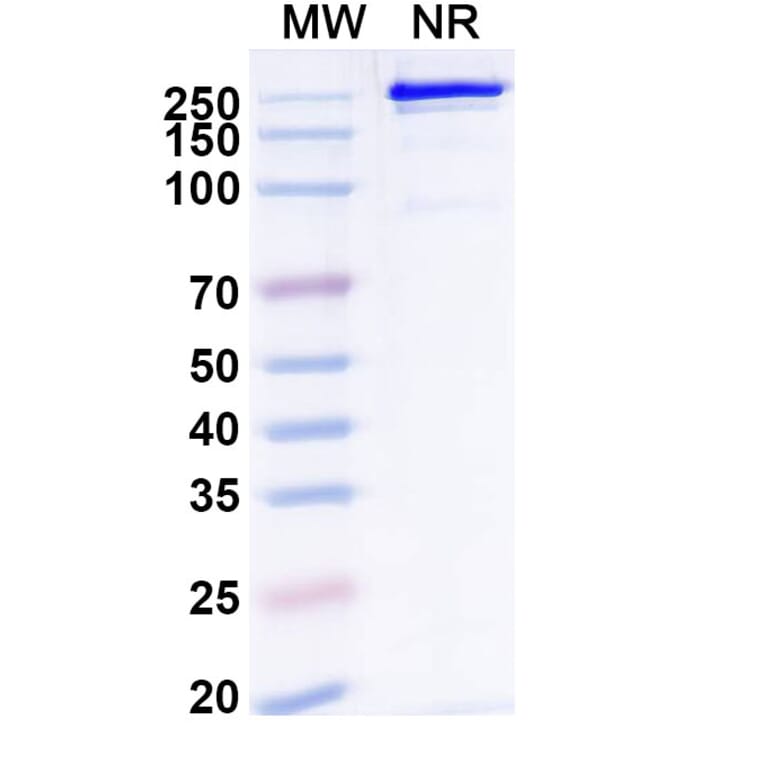 SDS-PAGE - Remternetug Biosimilar - Anti-APP Antibody - BSA and Azide free (A340483) - Antibodies.com