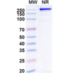 SDS-PAGE - Remternetug Biosimilar - Anti-APP Antibody - BSA and Azide free (A340483) - Antibodies.com