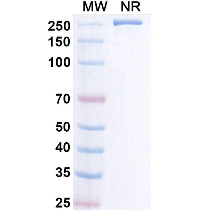 SDS-PAGE - Remternetug Biosimilar - Anti-APP Antibody - BSA and Azide free (A340483) - Antibodies.com