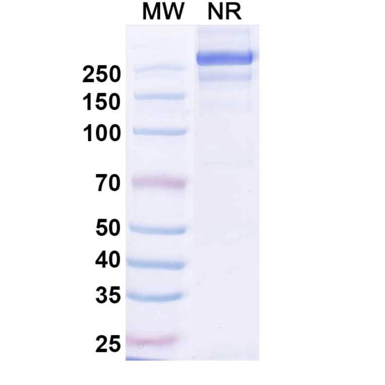 SDS-PAGE - Sabirnetug Biosimilar - Anti-APP Antibody - BSA and Azide free (A340484) - Antibodies.com