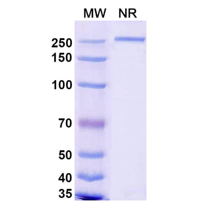 SDS-PAGE - Renvistobart Biosimilar - Anti-TIGIT Antibody - BSA and Azide free (A340485) - Antibodies.com