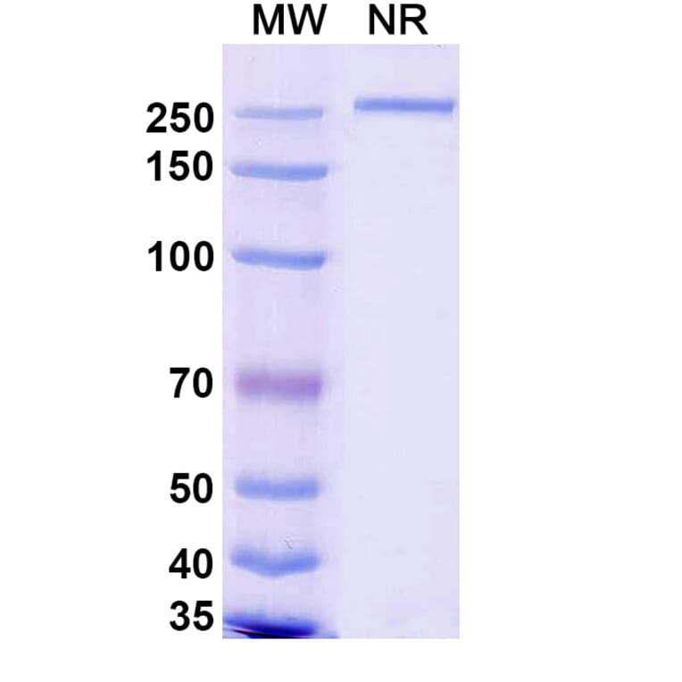 SDS-PAGE - Renvistobart Biosimilar - Anti-TIGIT Antibody - BSA and Azide free (A340485) - Antibodies.com