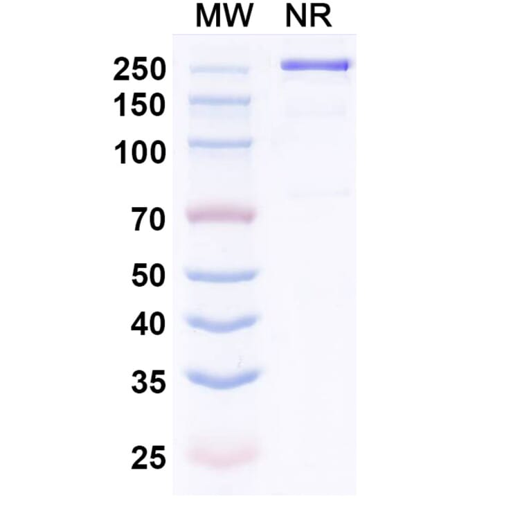 SDS-PAGE - Riliprubart Biosimilar - Anti-C1s Antibody - BSA and Azide free (A340486) - Antibodies.com