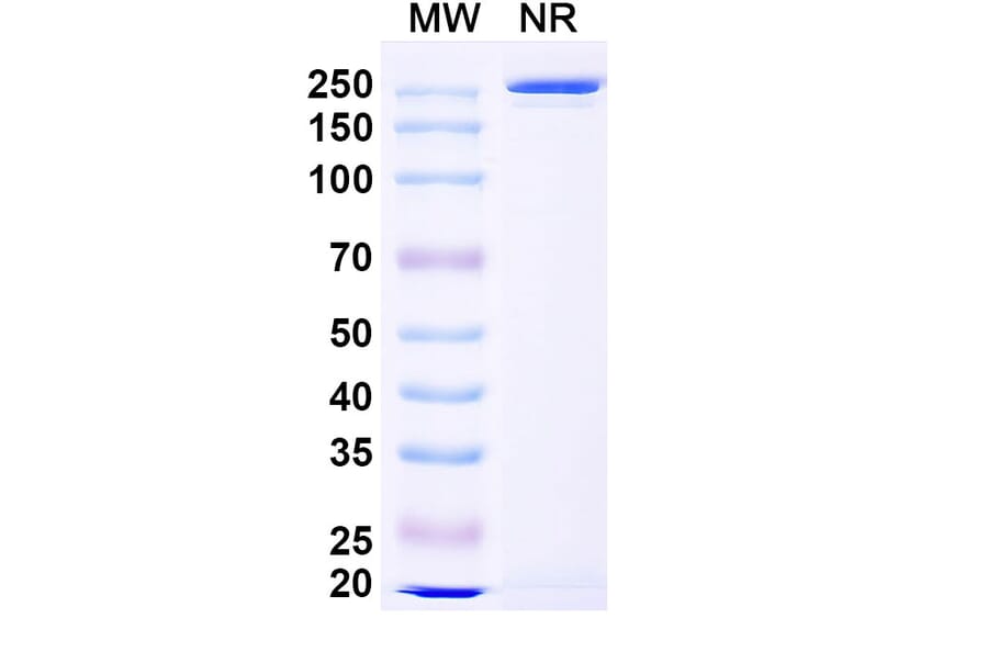 SDS-PAGE - Riliprubart Biosimilar - Anti-C1s Antibody - BSA and Azide free (A340486) - Antibodies.com