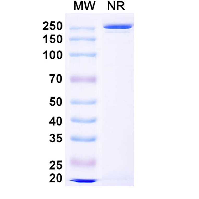 SDS-PAGE - Riliprubart Biosimilar - Anti-C1s Antibody - BSA and Azide free (A340486) - Antibodies.com