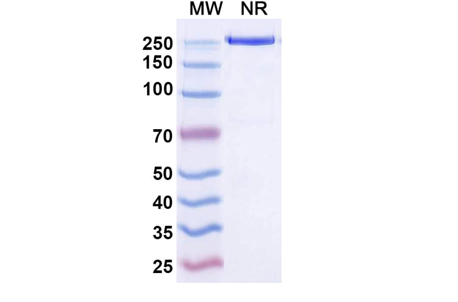SDS-PAGE - Temtokibart Biosimilar - Anti-IL-22RA1 Antibody - BSA and Azide free (A340489) - Antibodies.com