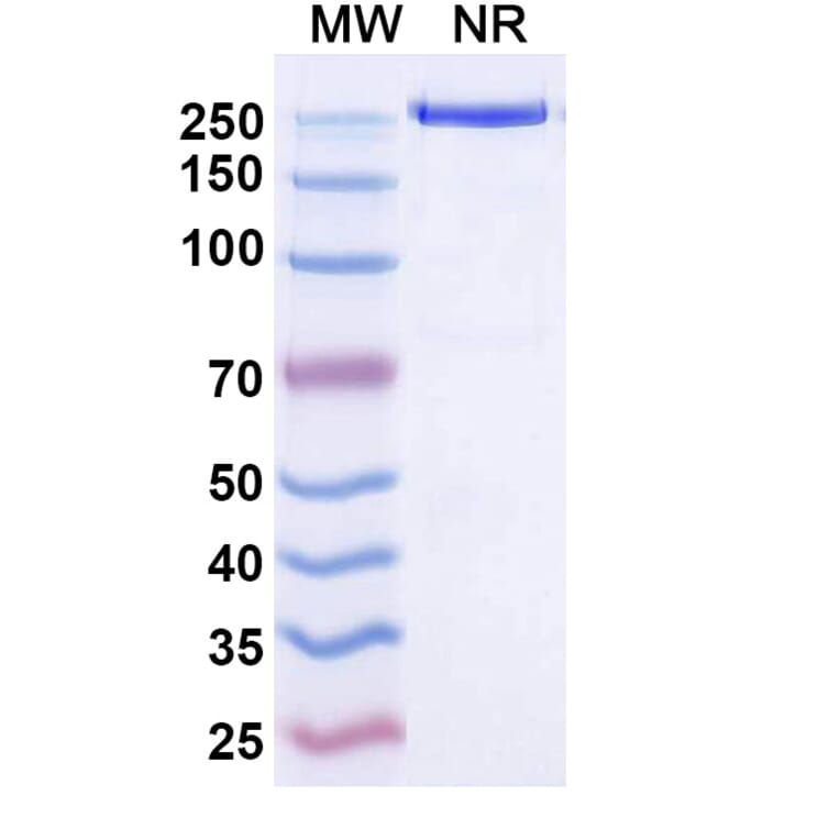 SDS-PAGE - Temtokibart Biosimilar - Anti-IL-22RA1 Antibody - BSA and Azide free (A340489) - Antibodies.com