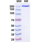 SDS-PAGE - Temtokibart Biosimilar - Anti-IL-22RA1 Antibody - BSA and Azide free (A340489) - Antibodies.com