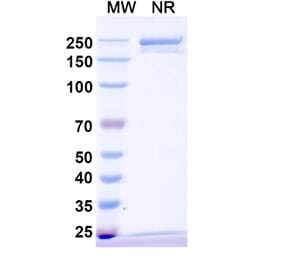 SDS-PAGE - Vamikibart Biosimilar - Anti-IL-6 Antibody - BSA and Azide free (A340491) - Antibodies.com