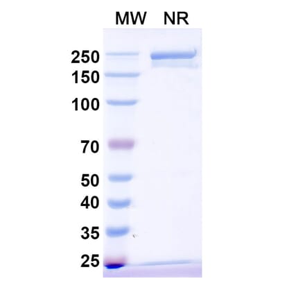 SDS-PAGE - Vamikibart Biosimilar - Anti-IL-6 Antibody - BSA and Azide free (A340491) - Antibodies.com