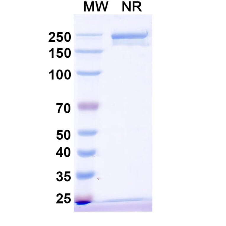 SDS-PAGE - Vamikibart Biosimilar - Anti-IL-6 Antibody - BSA and Azide free (A340491) - Antibodies.com