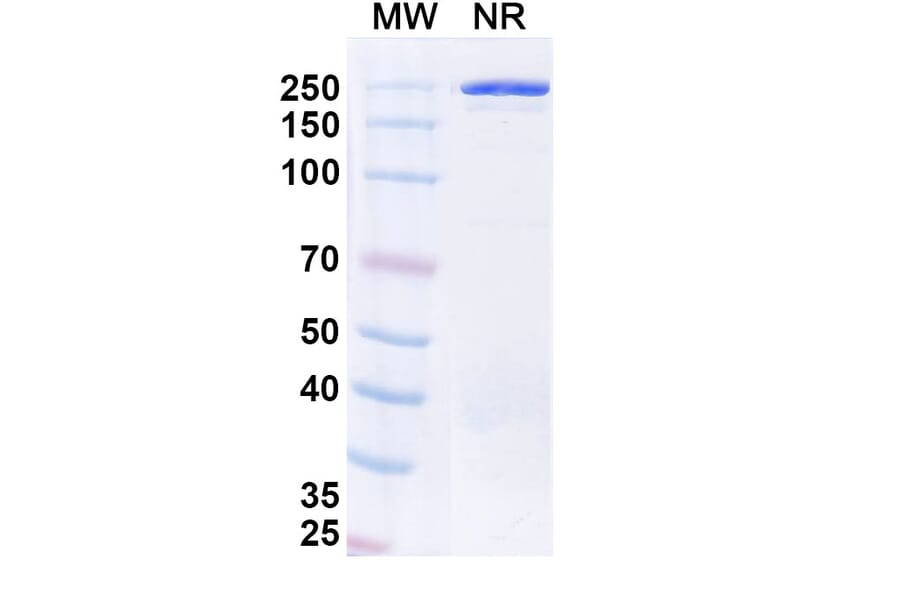 SDS-PAGE - Veligrotug Biosimilar - Anti-IGF1R Antibody - BSA and Azide free (A340492) - Antibodies.com