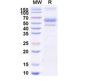 SDS-PAGE - Berahyaluronidase Alfa Biosimilar - Anti-SPAM1 Antibody - BSA and Azide free (A340502) - Antibodies.com