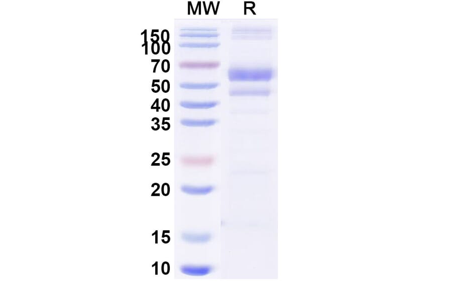 SDS-PAGE - Berahyaluronidase Alfa Biosimilar - Anti-SPAM1 Antibody - BSA and Azide free (A340502) - Antibodies.com