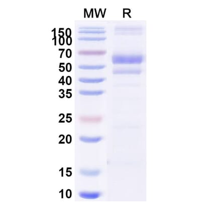 SDS-PAGE - Berahyaluronidase Alfa Biosimilar - Anti-SPAM1 Antibody - BSA and Azide free (A340502) - Antibodies.com